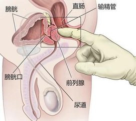 治疗前列腺炎症哪家医院较好